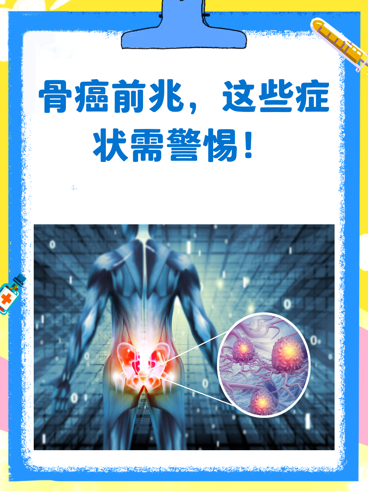 骨癌是什么原因引起的?