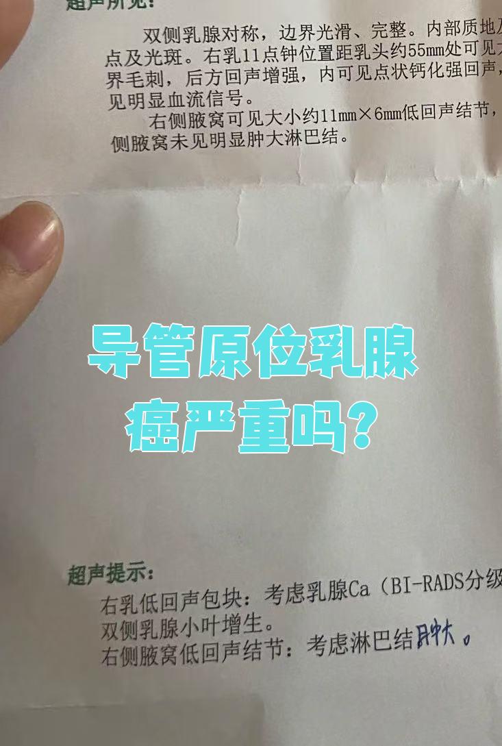什么是乳腺导管癌