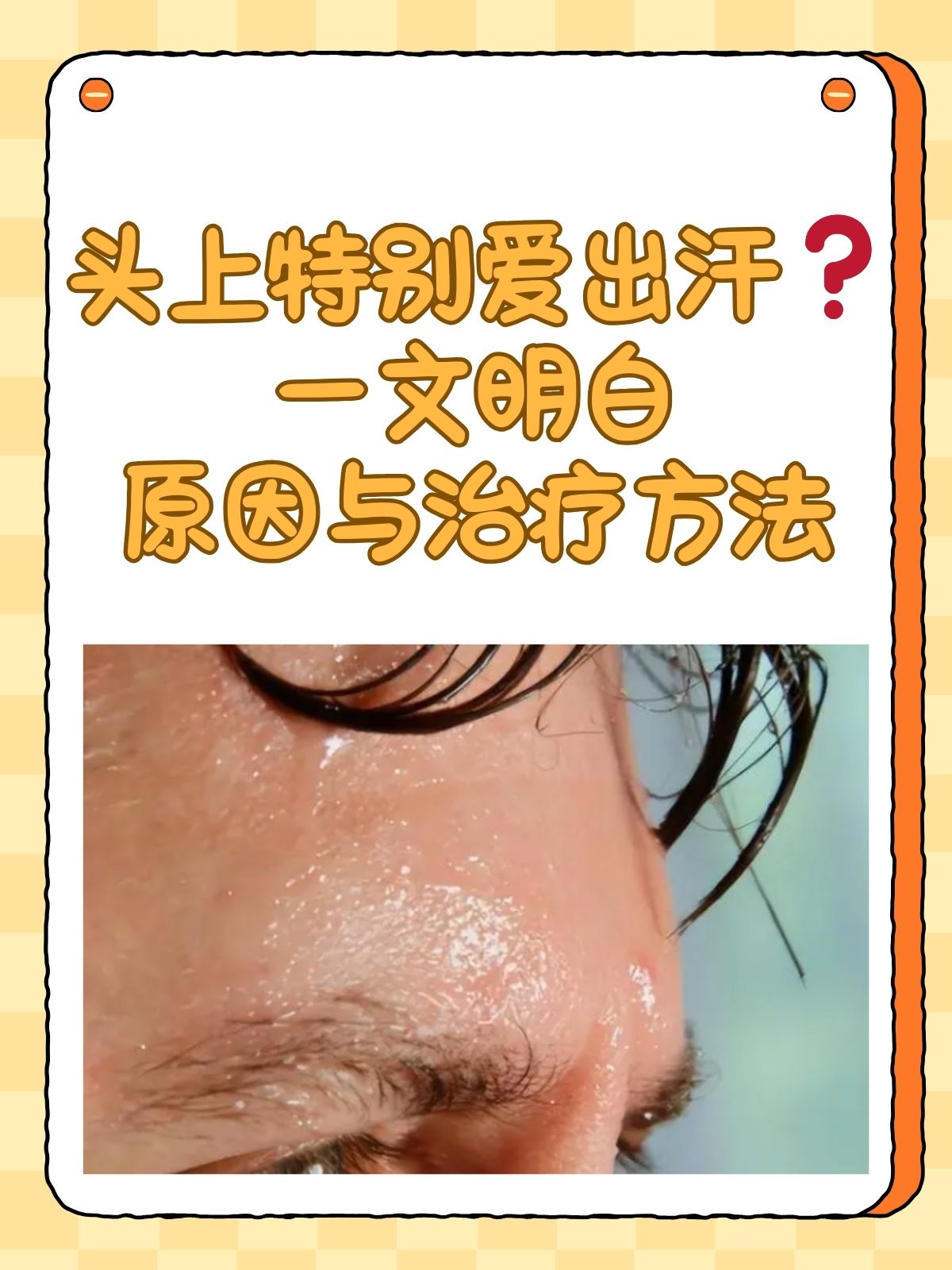 特别爱出汗是怎么回事