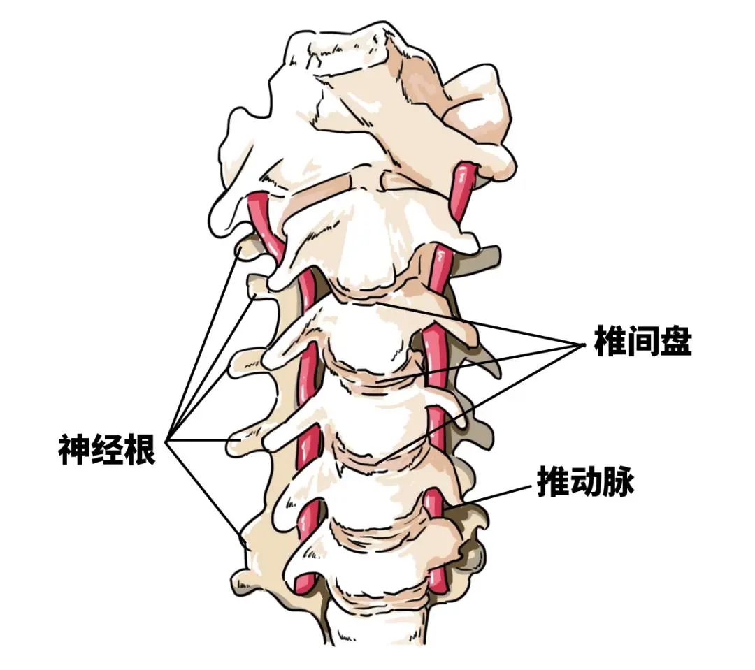 什么是颈椎间盘突出症