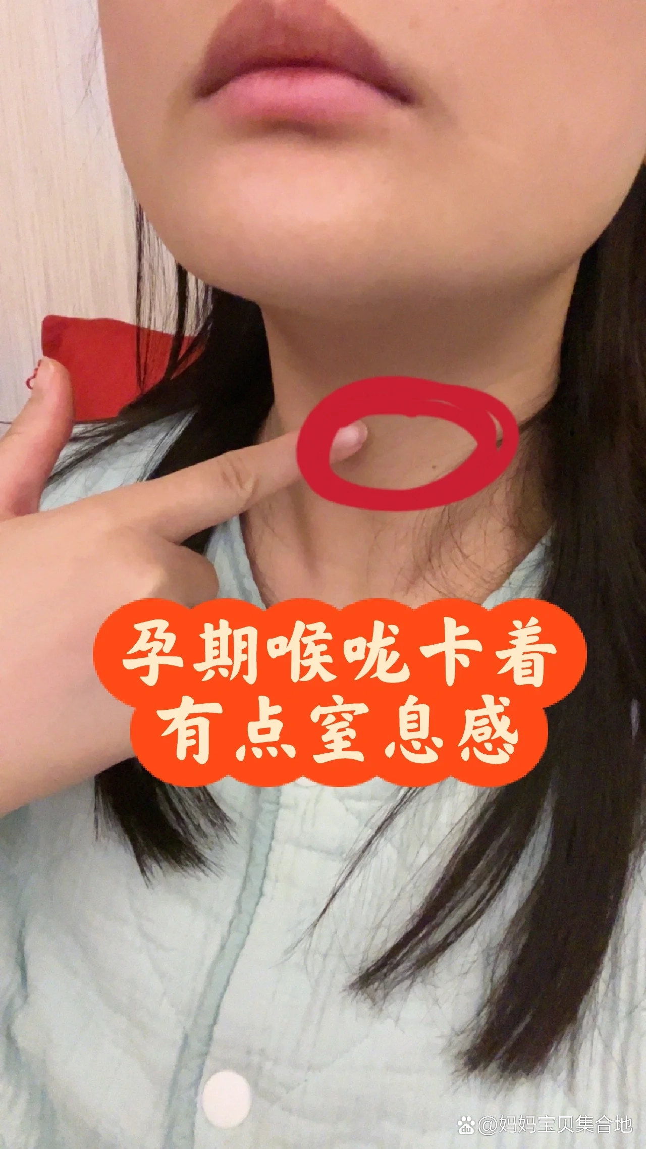 怀孕嗓子疼怎么办