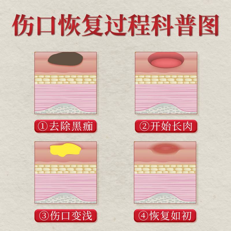 伤口愈合的过程是什么