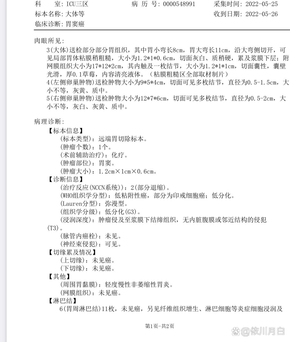 胃癌术后的转移复发时间