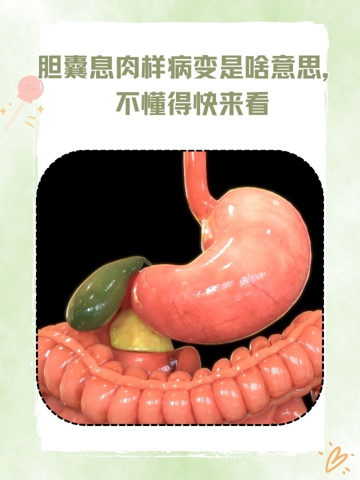 检查有胆囊息肉如何治疗
