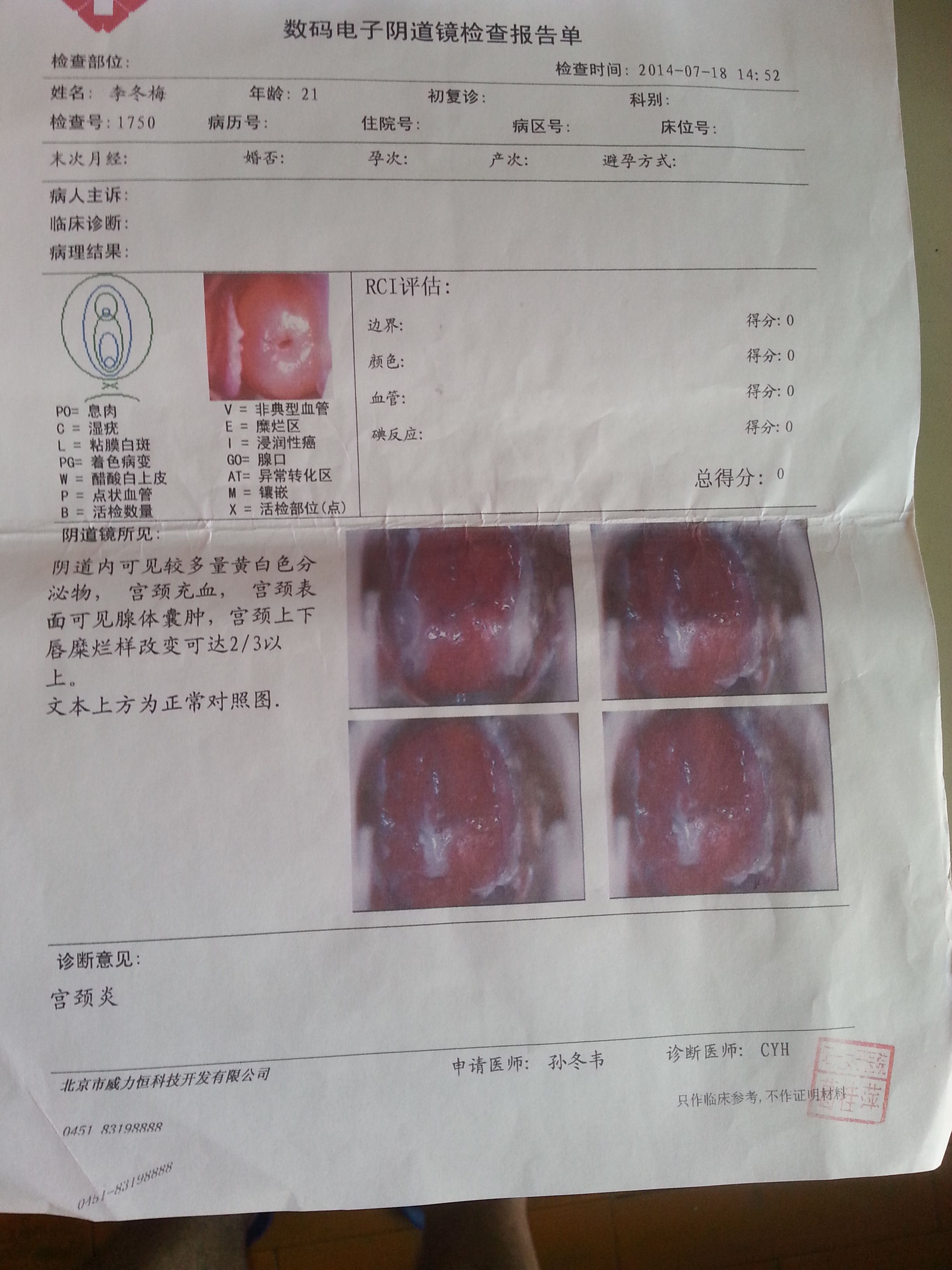 宫颈糜烂可以痊愈么?