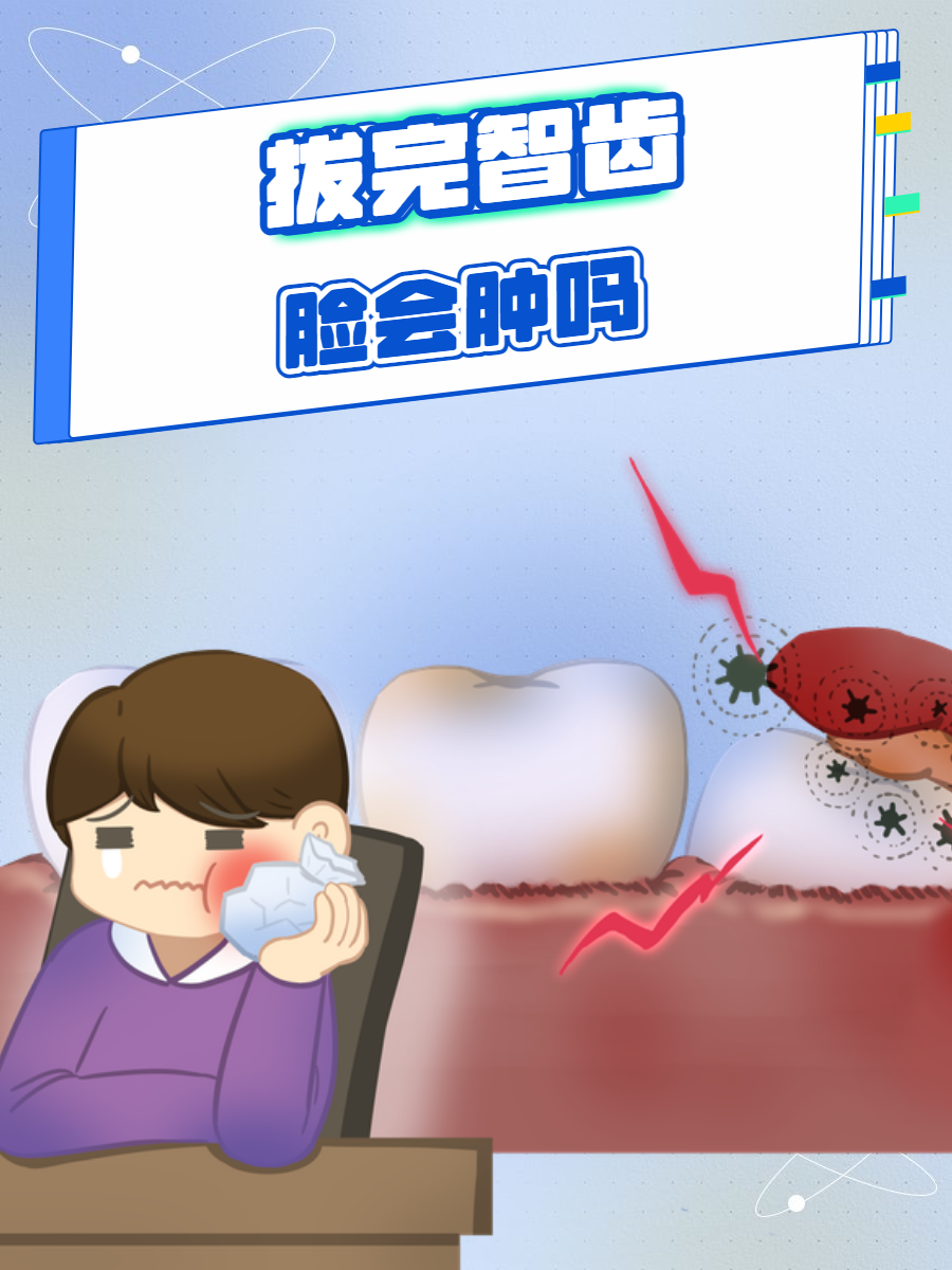 拔牙脸肿怎么消肿