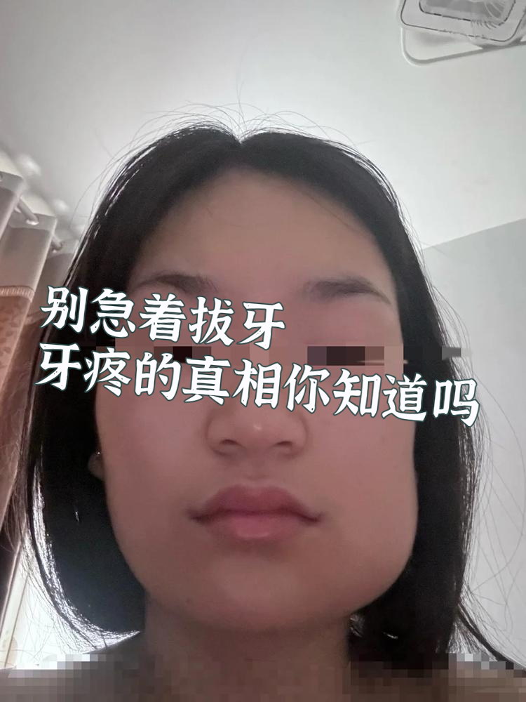 拔牙脸肿怎么消肿
