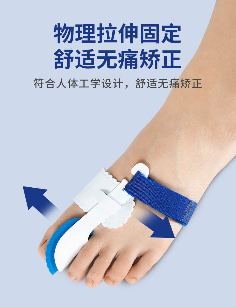 拇外翻矫正器管用吗