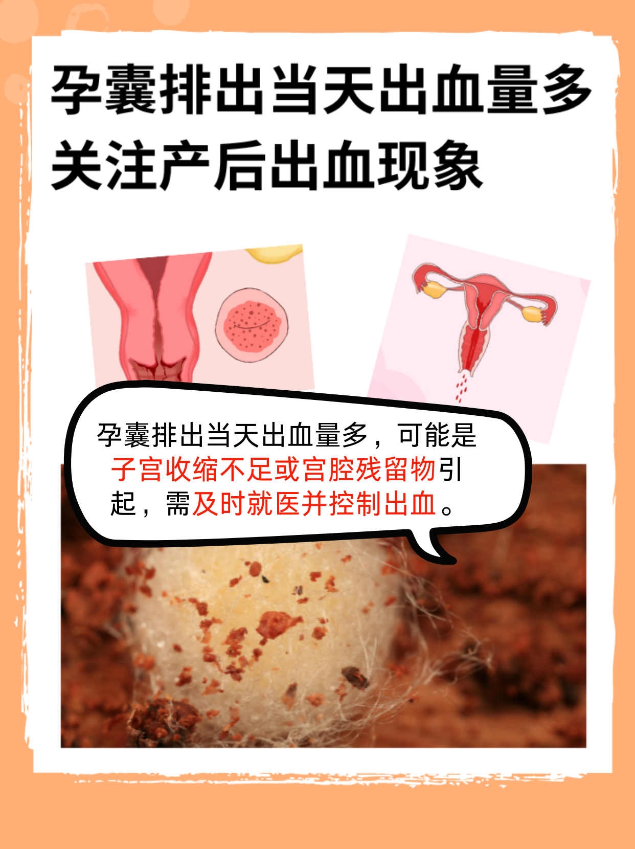 为什么会自然流产?