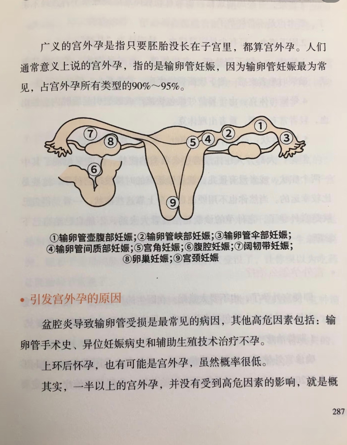 宫外孕最佳的处理方法