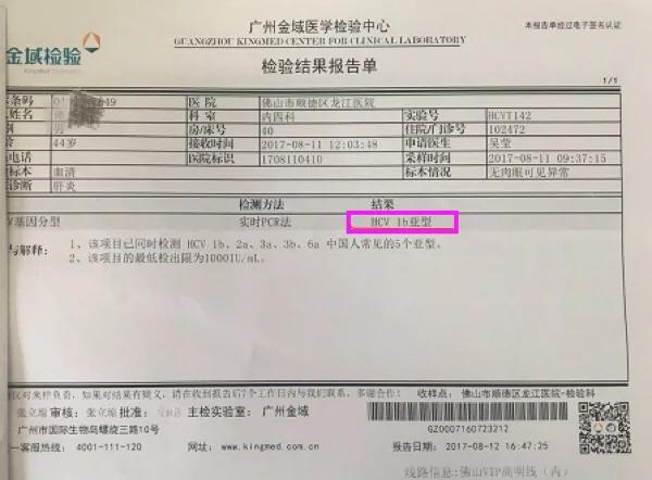 丙肝病严重吗