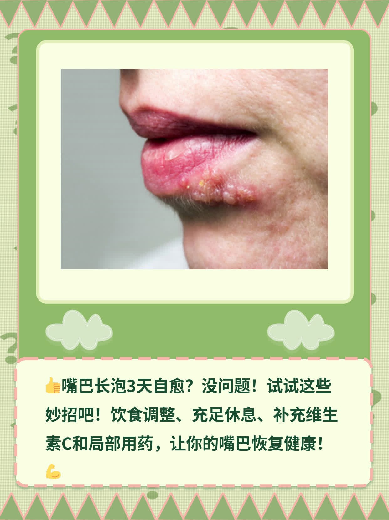 嘴上长疱疹怎么办