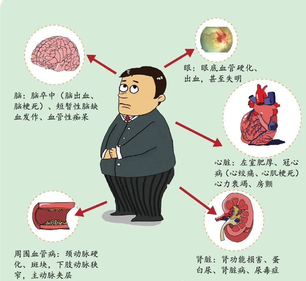 高血压最严重的并发症是什么?