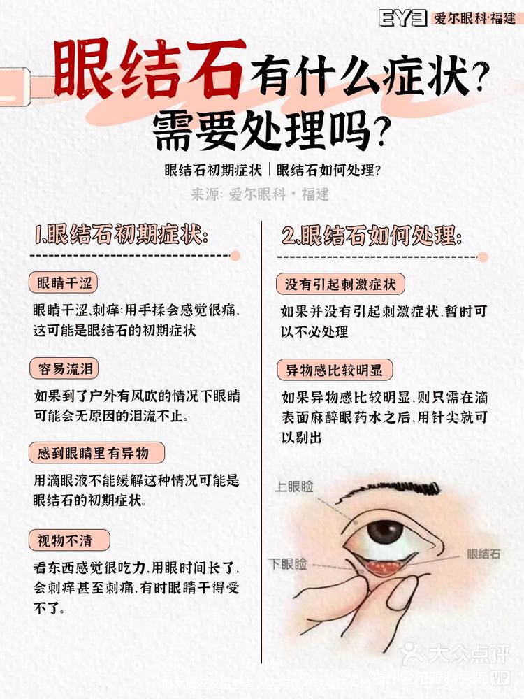 眼屎多怎么治疗