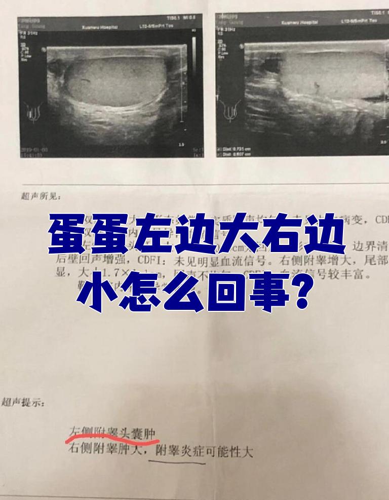 两个睾丸不一样大怎么回事?
