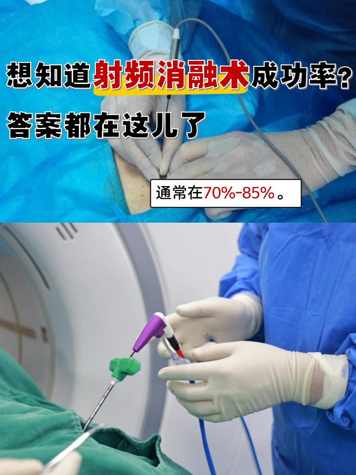 低温等离子消融术手术的益处与危害