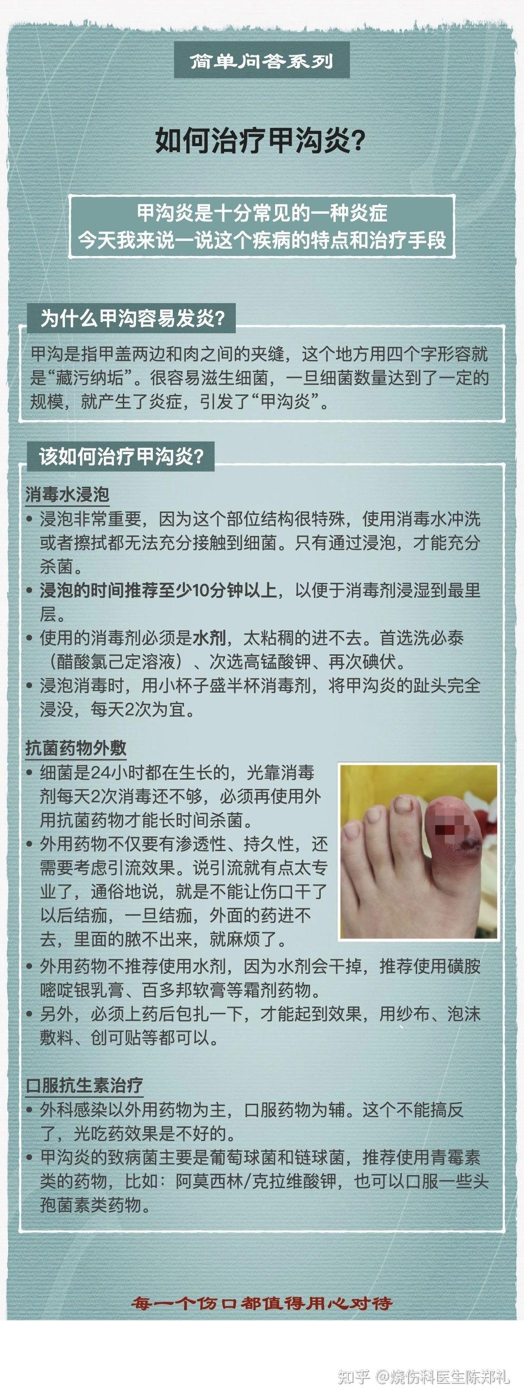 手指甲沟炎怎么治疗