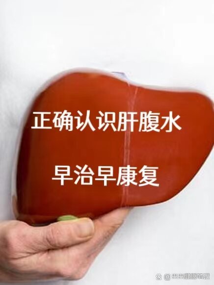 肝腹水能完全治愈吗?