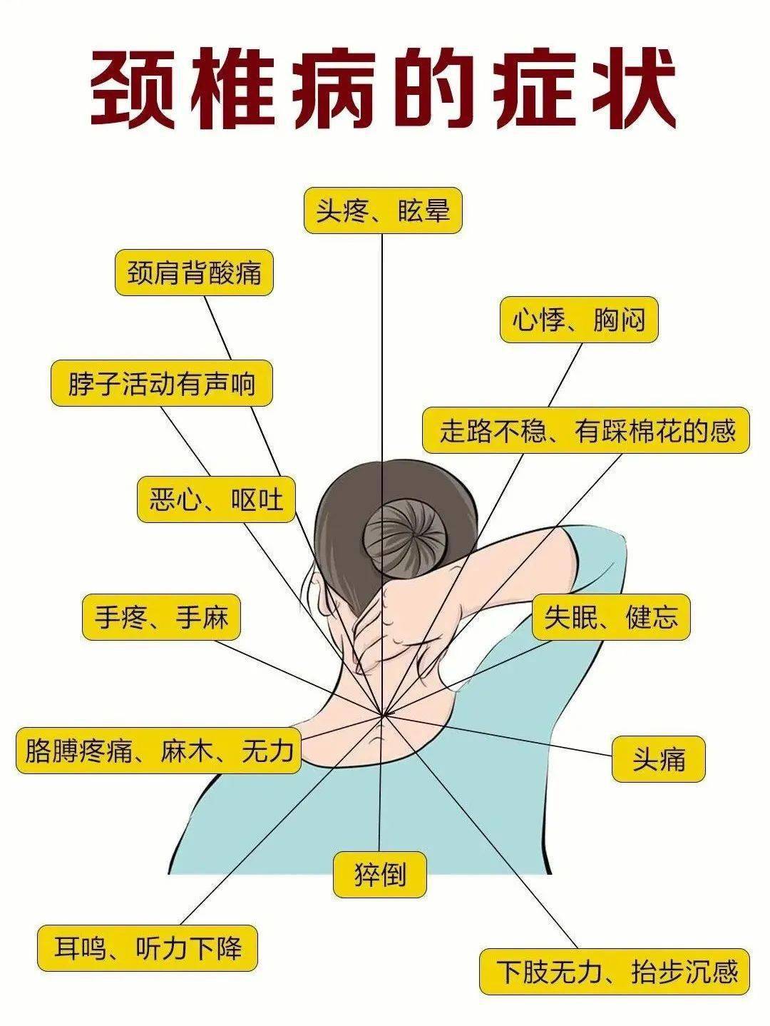 颈椎病分哪几种类型