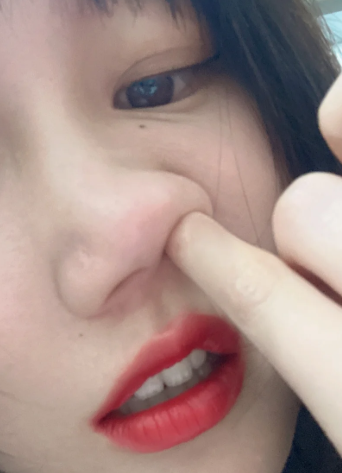 鼻子有鼻涕白色特别黏