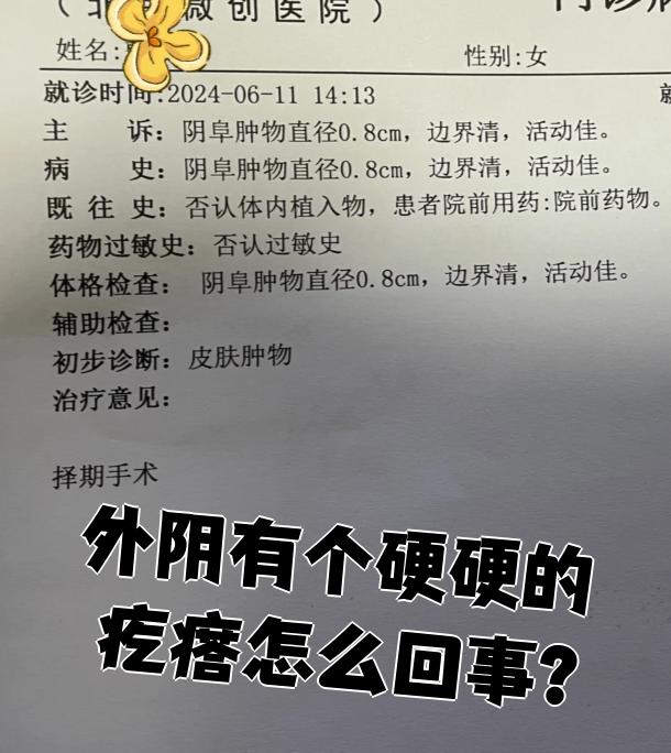 女性私处长了个小包是什么