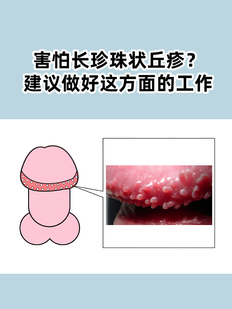 冠状沟上有白色小颗粒