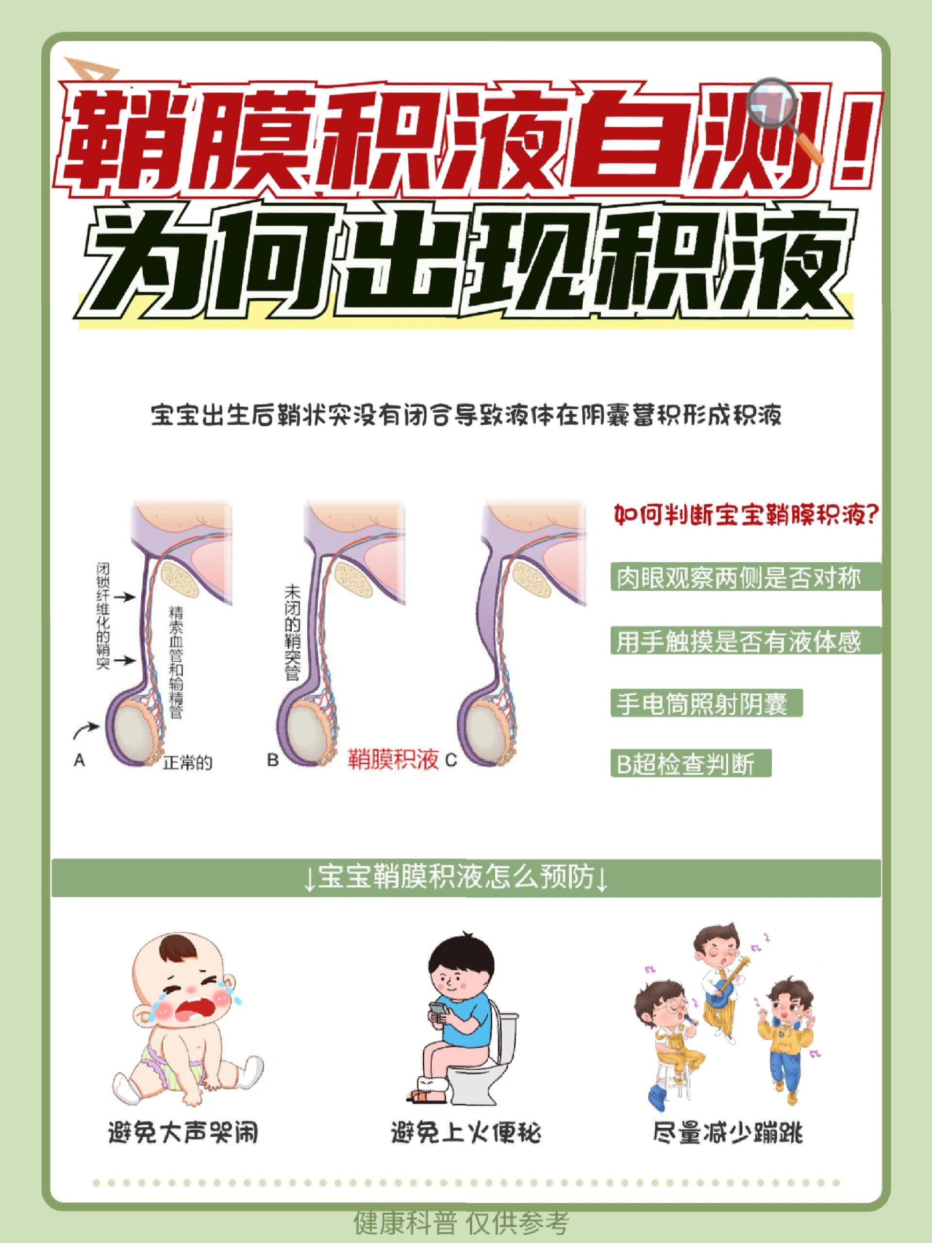 新生儿鞘膜积液