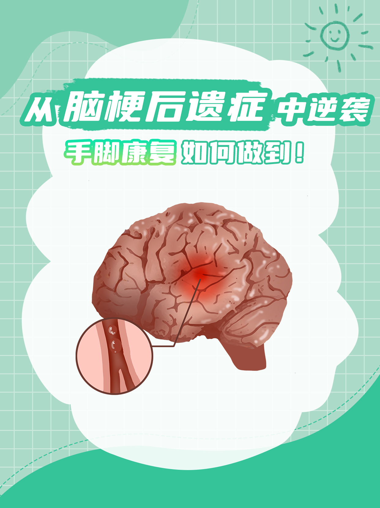 颅脑损伤后遗症的表现