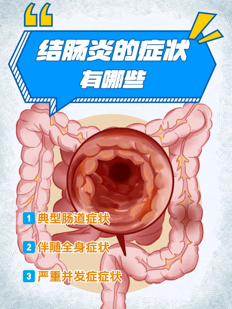 慢性肠炎的症状和治疗