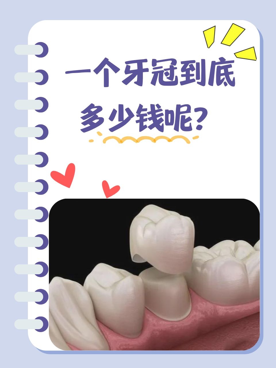 谁知道美容冠是什么?