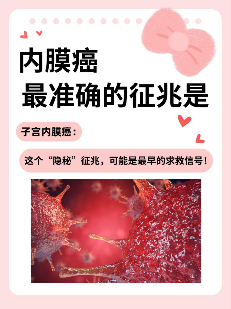 子宫内膜癌怎么检查出来