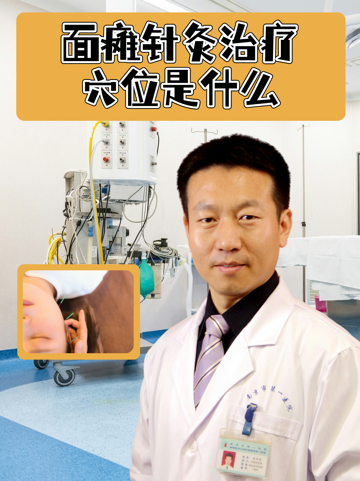 针灸可以治疗面瘫吗?