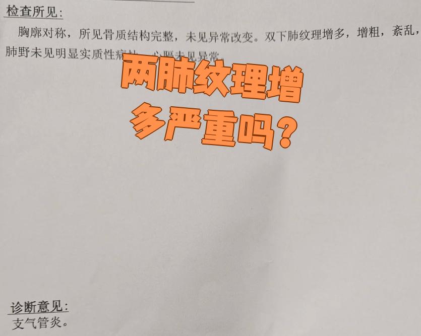 双肺纹理增强什么意思?