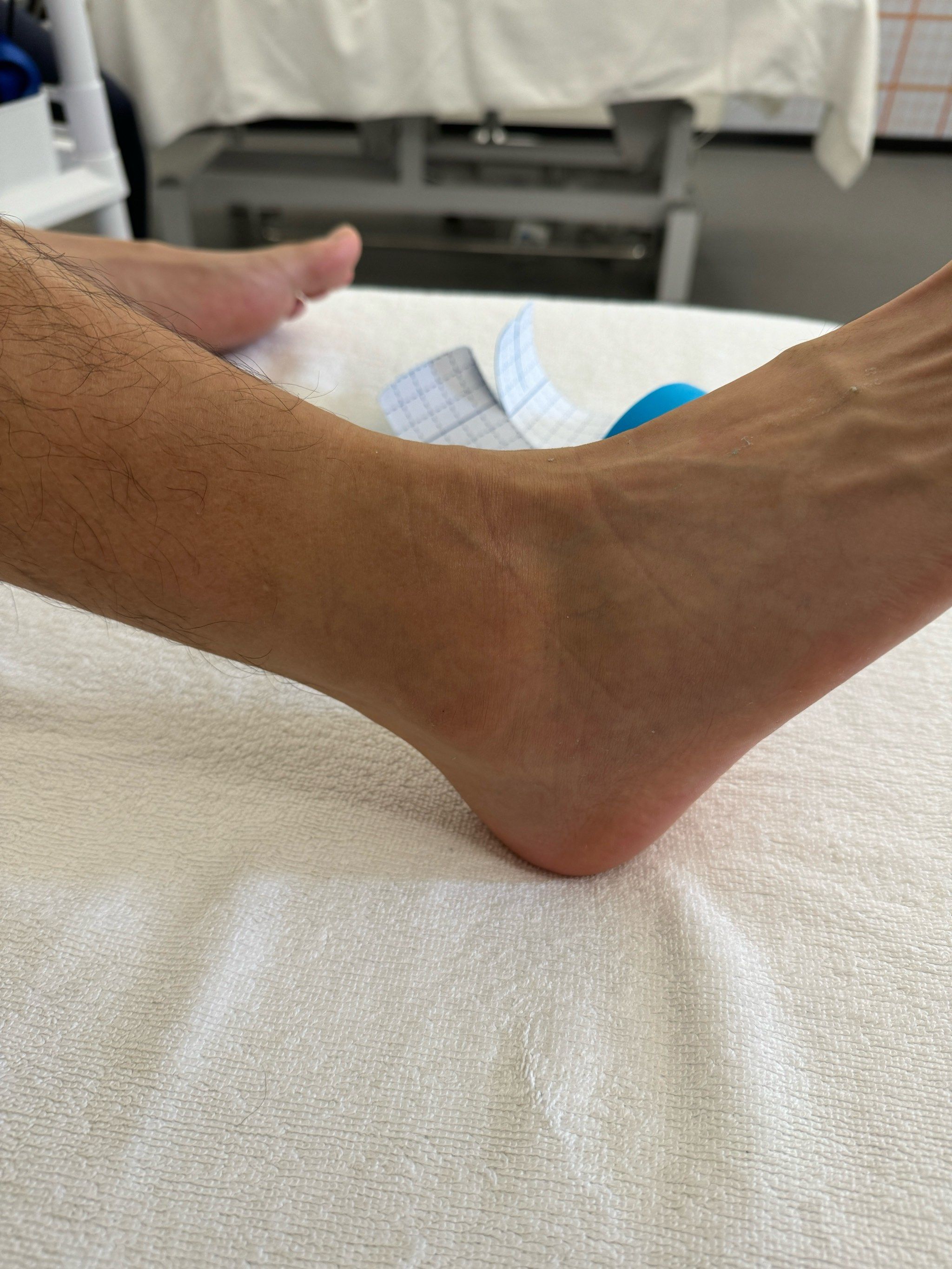 脚踝扭伤,多久能好?