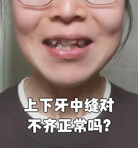 牙列不齐的症状有哪些?