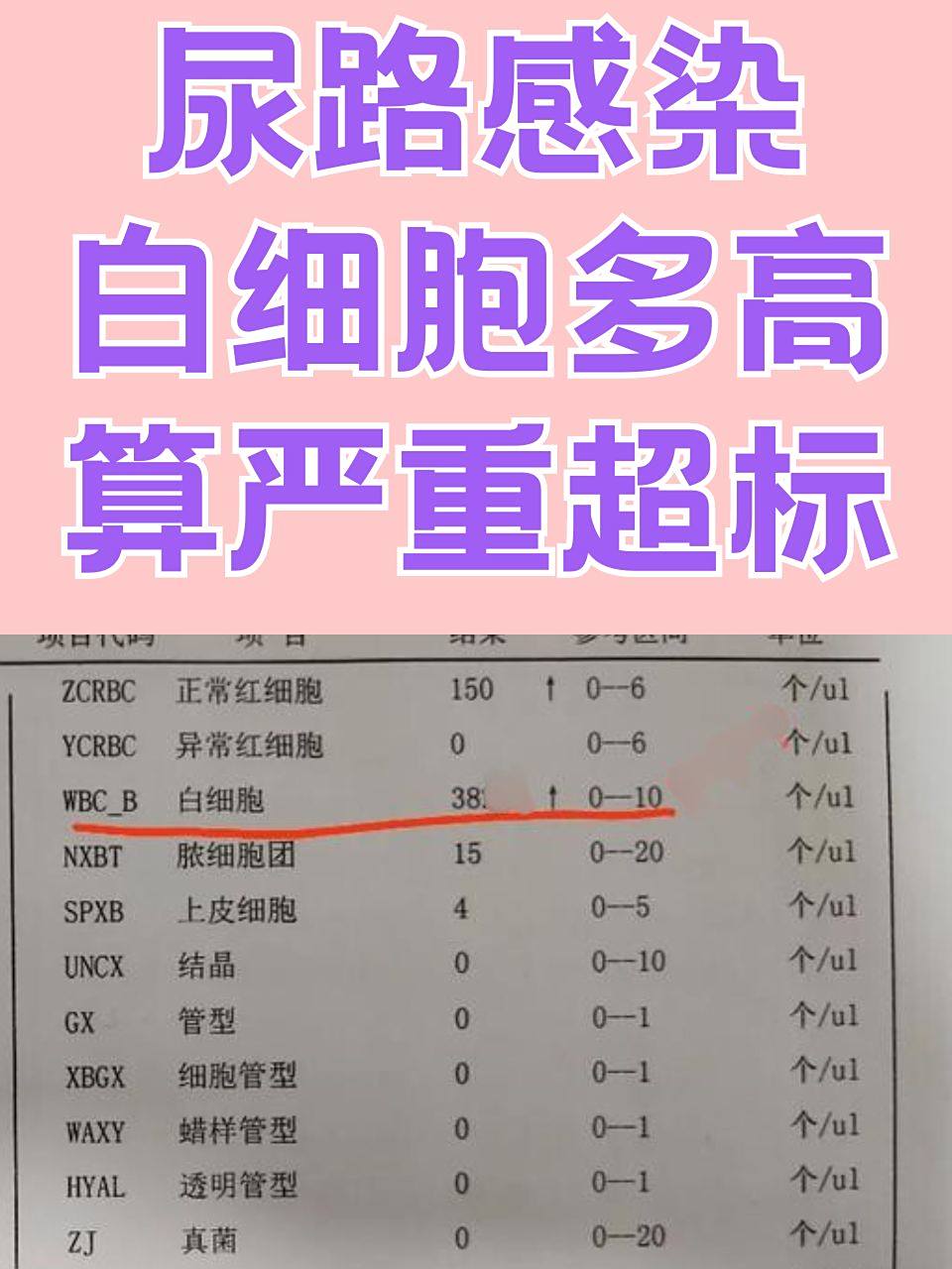 白细胞高的原因有哪些?