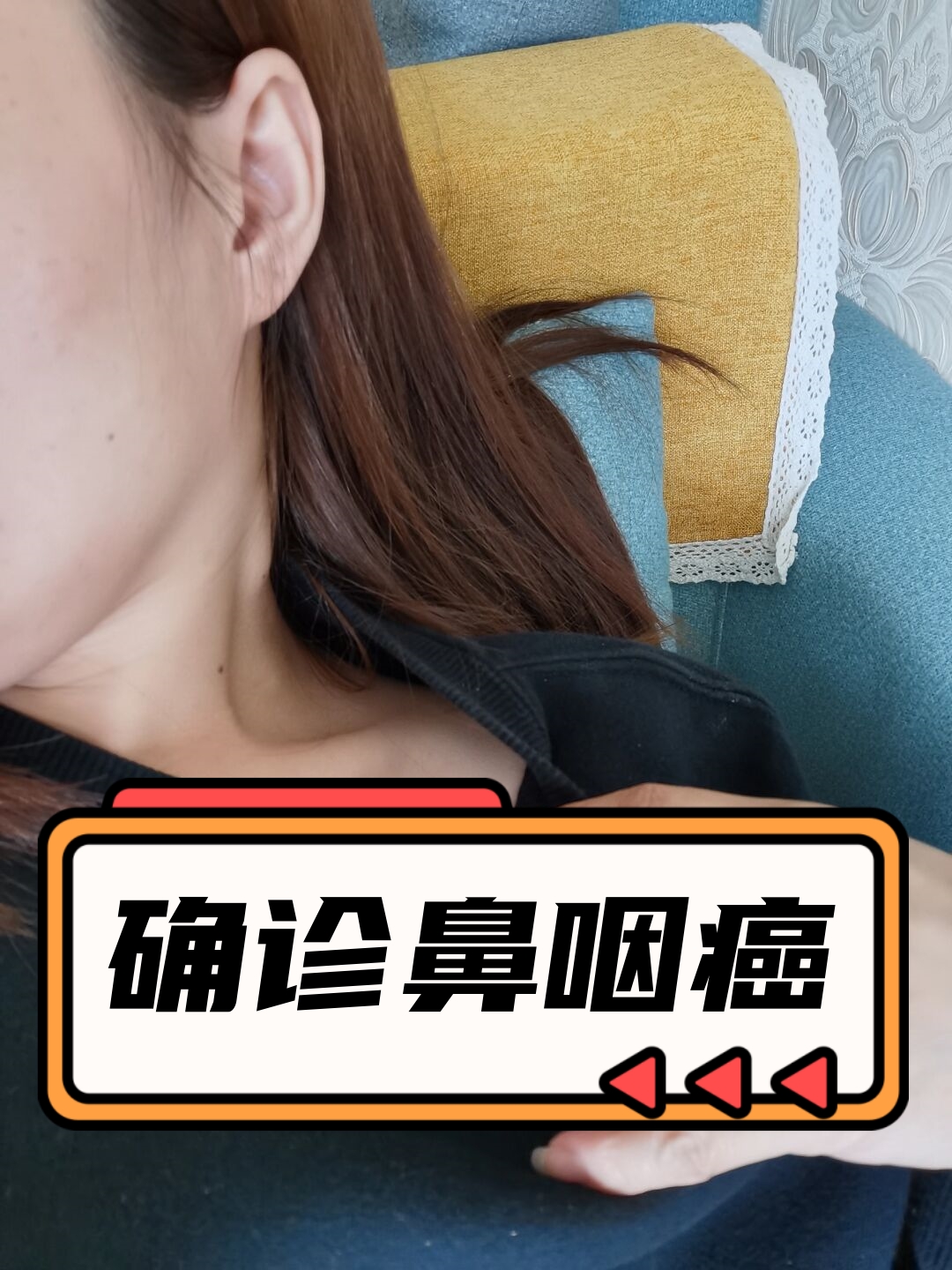 鼻咽癌的早期症状是什么?