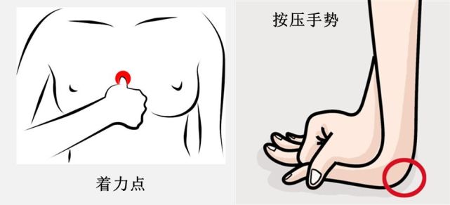 如何进行胸外心脏按压