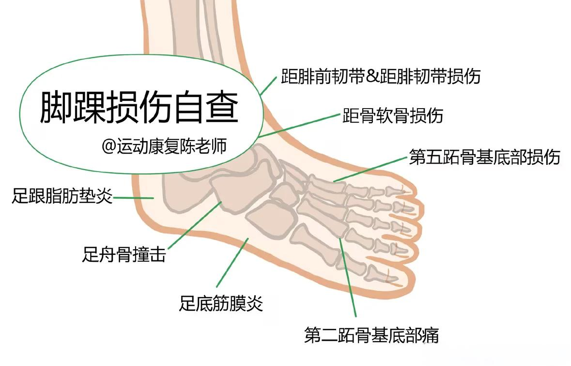 脚踝疼痛是什么原因