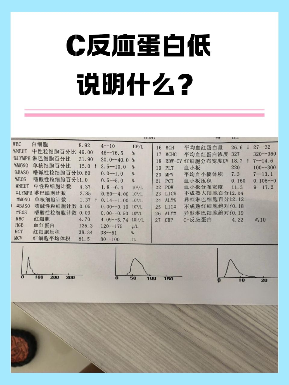 免疫球蛋白G偏高会怎样