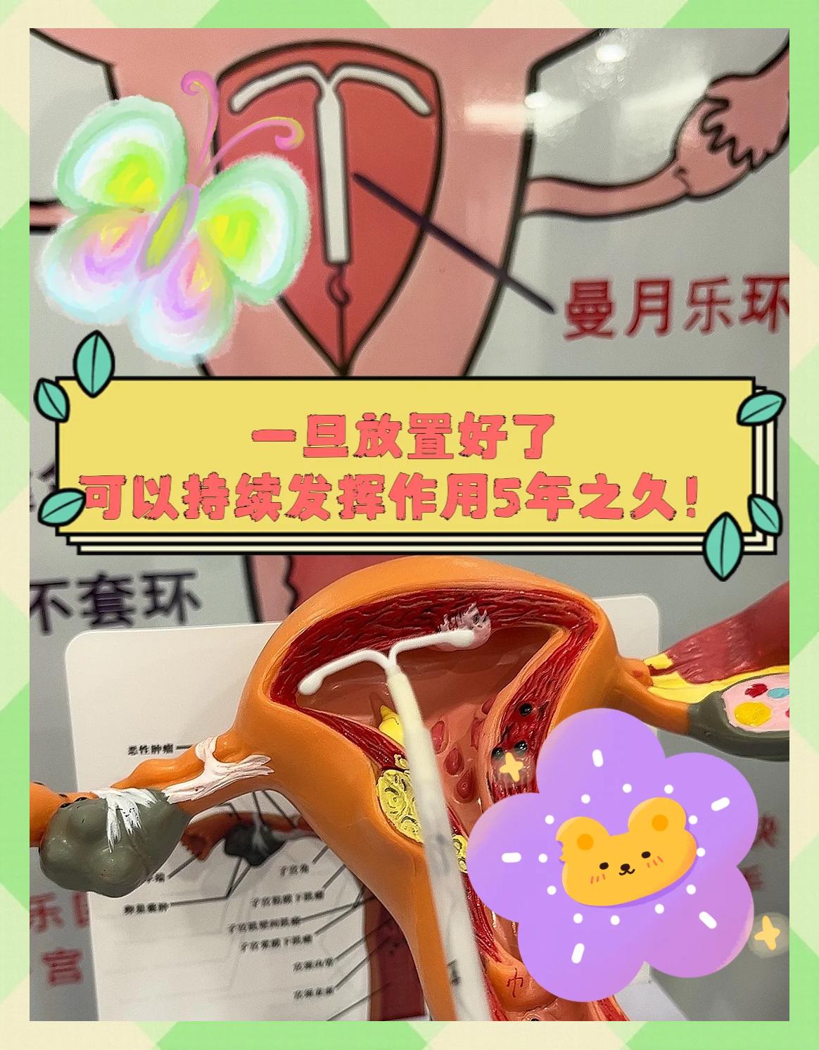 曼月乐环月经老不干净怎么办