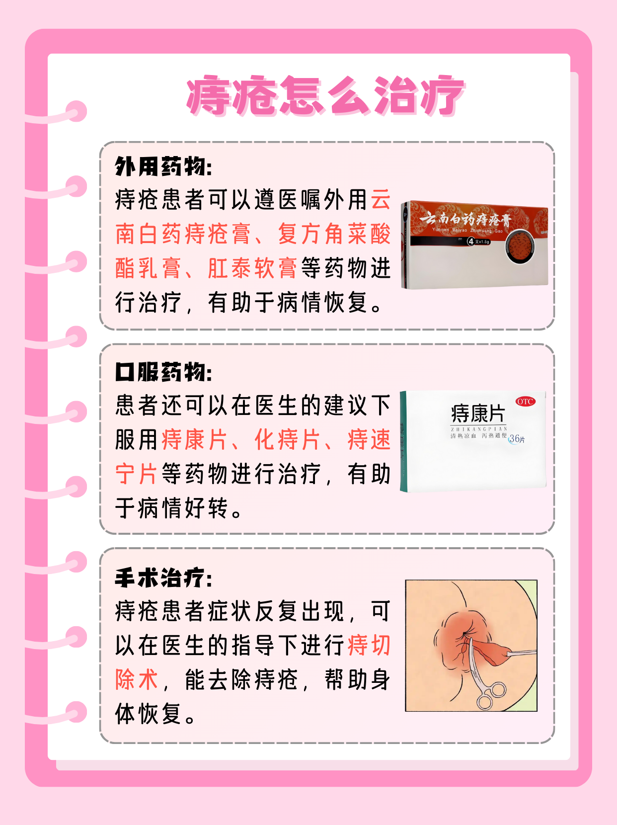 内痔的治疗方法