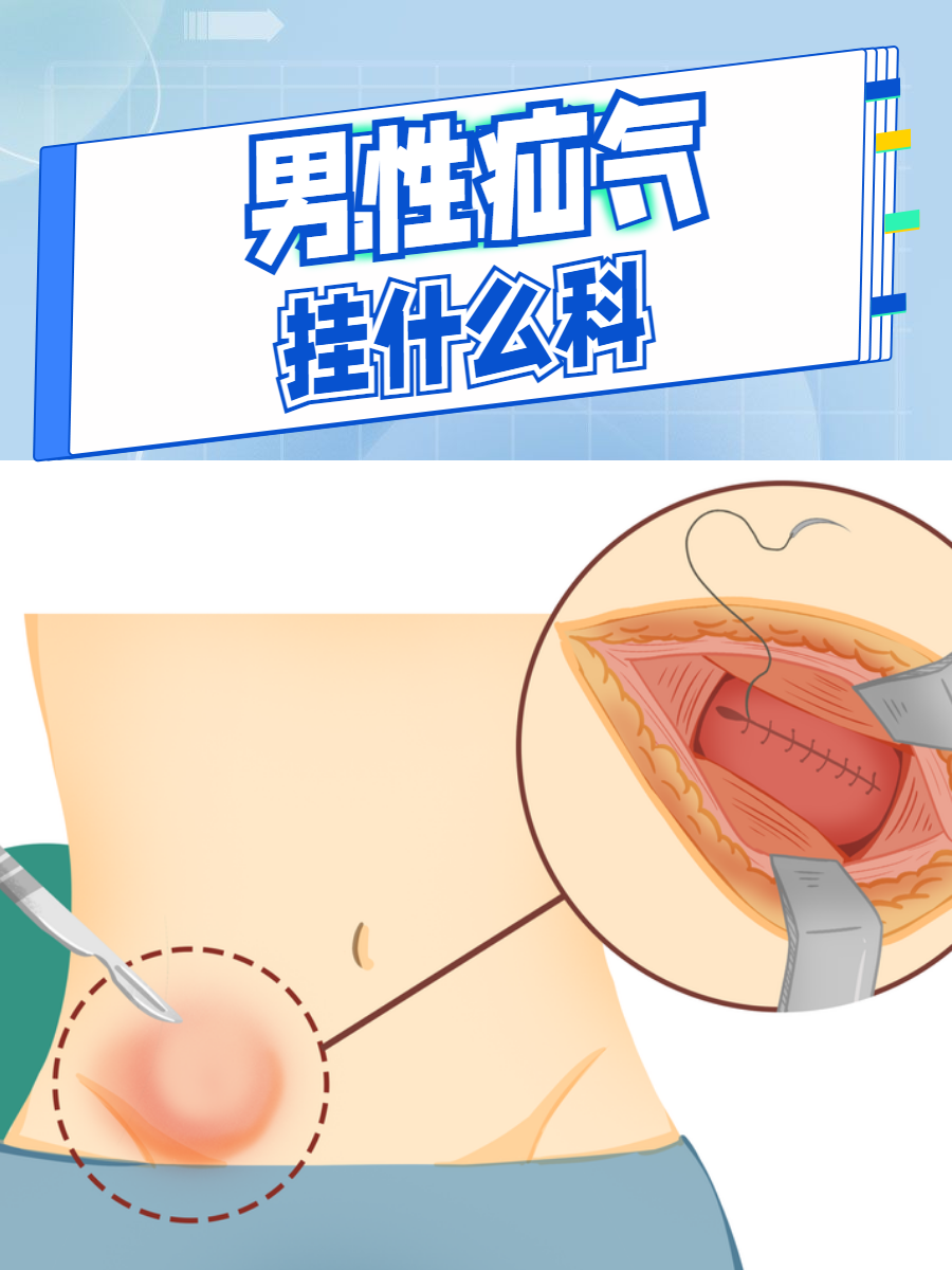 男人疝气症状图片