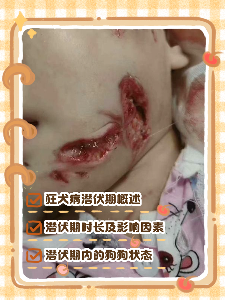 狂犬病发病症状是什么