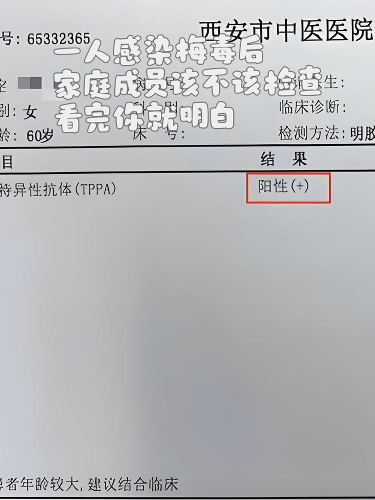 梅毒检测rpr阴性是什么意思