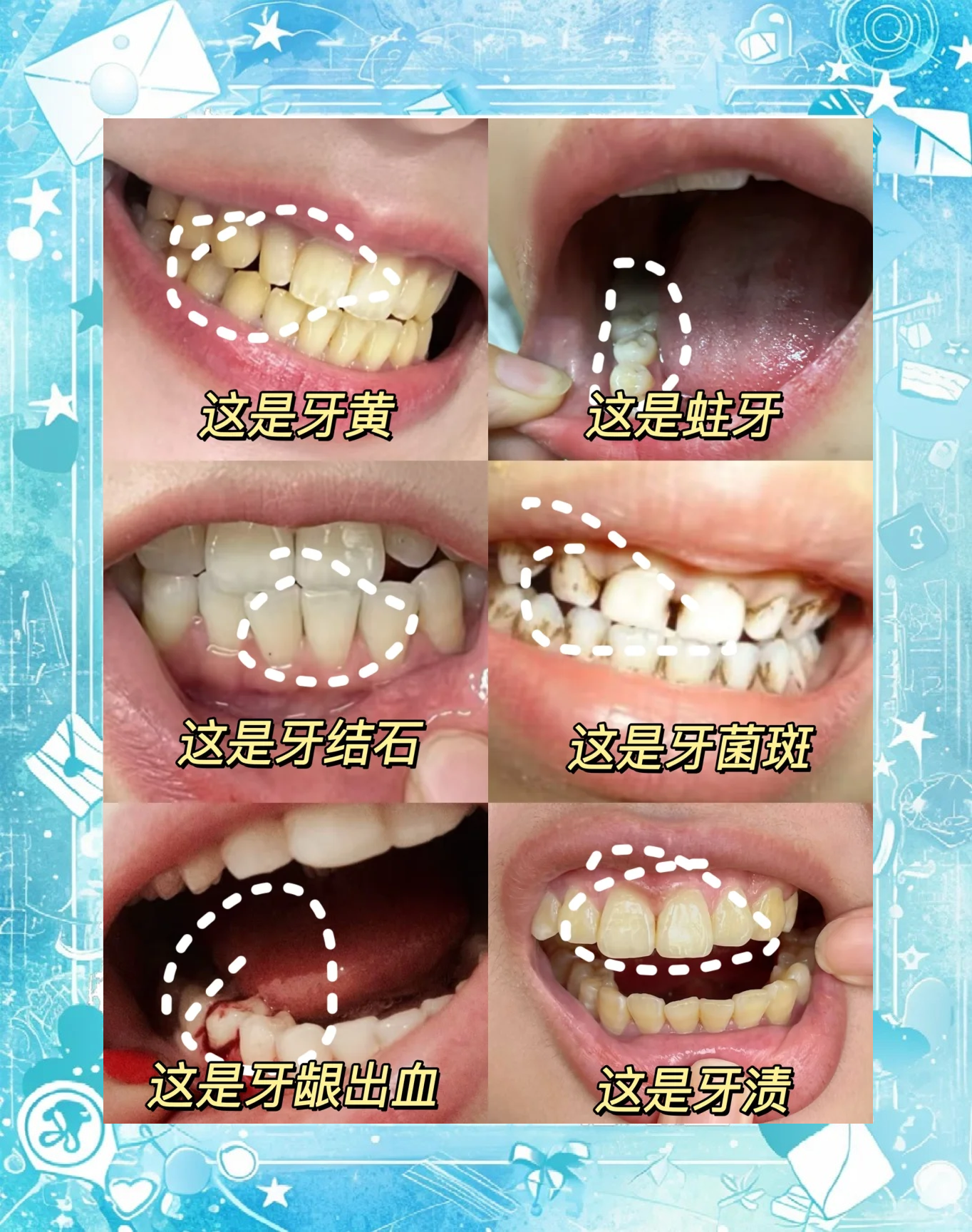 牙齿变白最快的方法