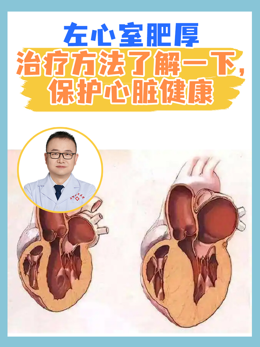 左心房增大是怎么病?