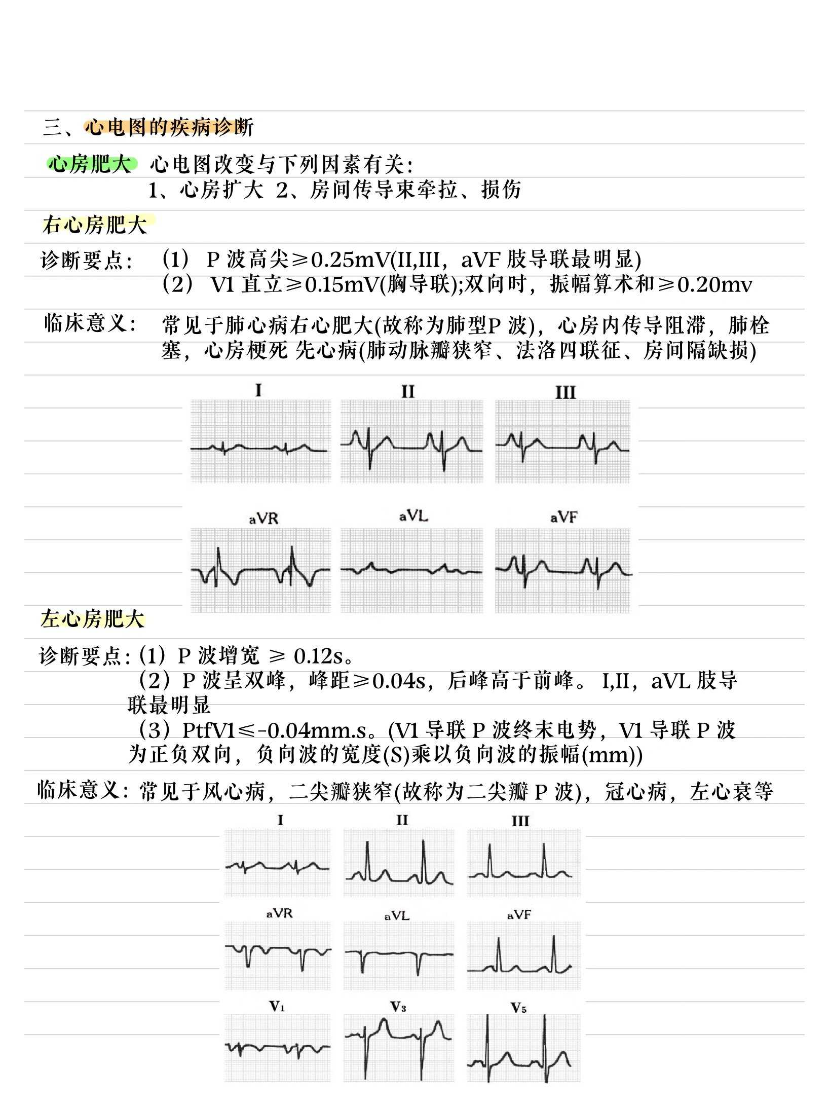 左心房增大是怎么病?