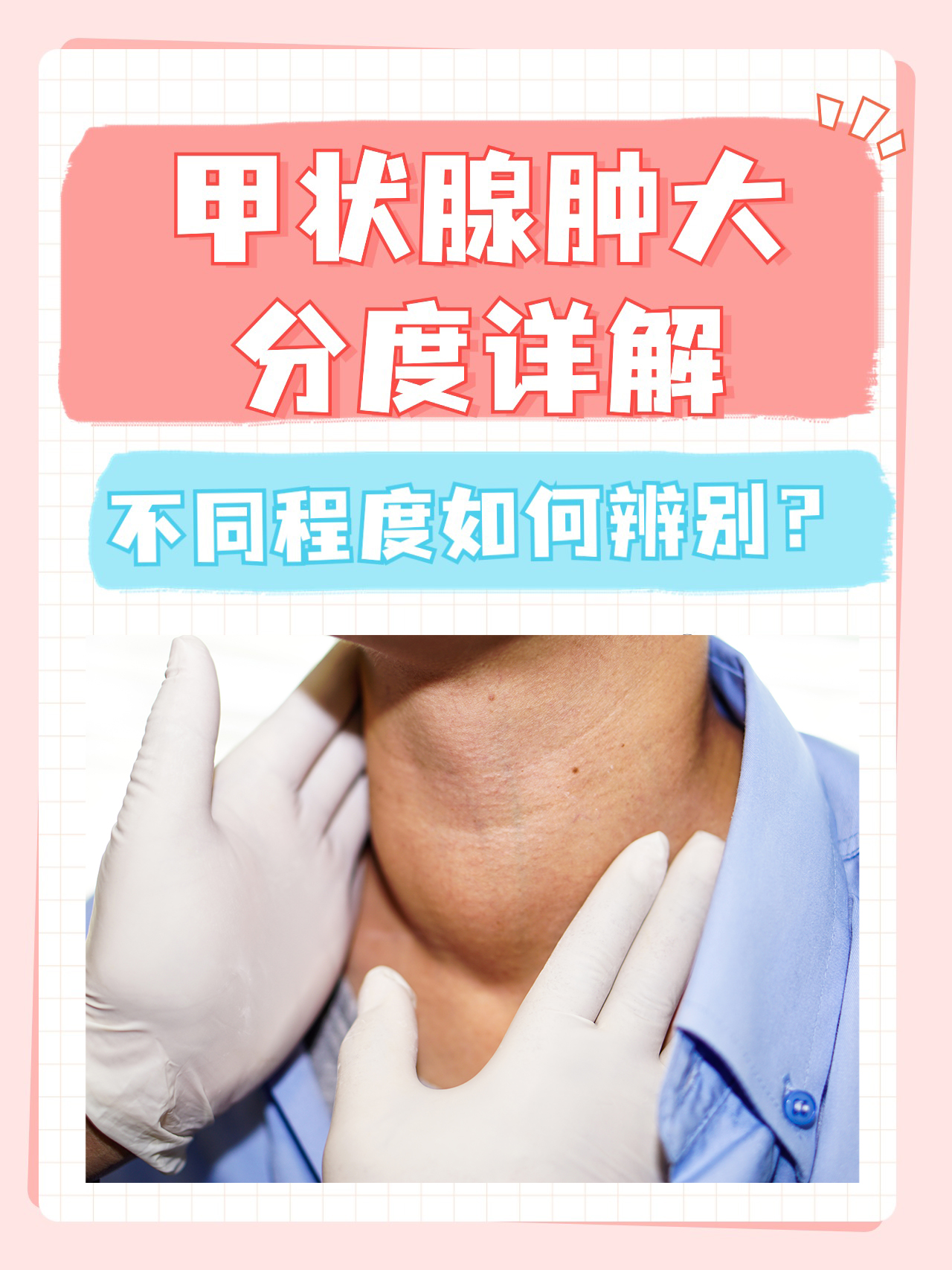 甲状腺疾病有哪几种