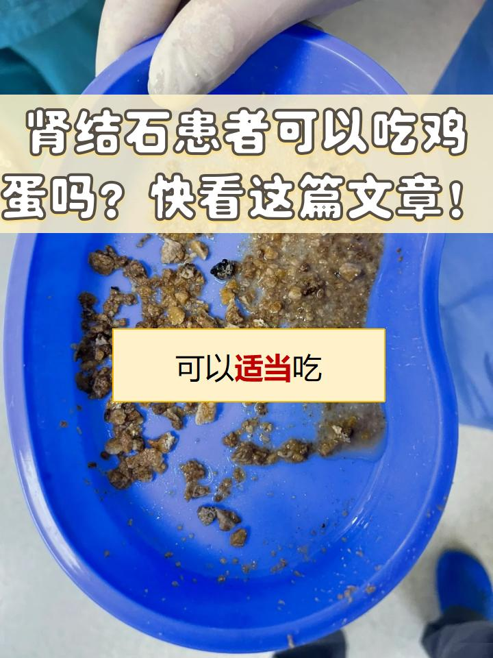 肾结石能吃什么